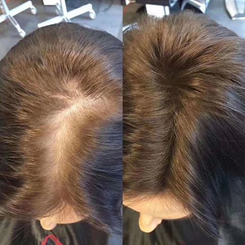 Hairline Powder (Brown & Black)